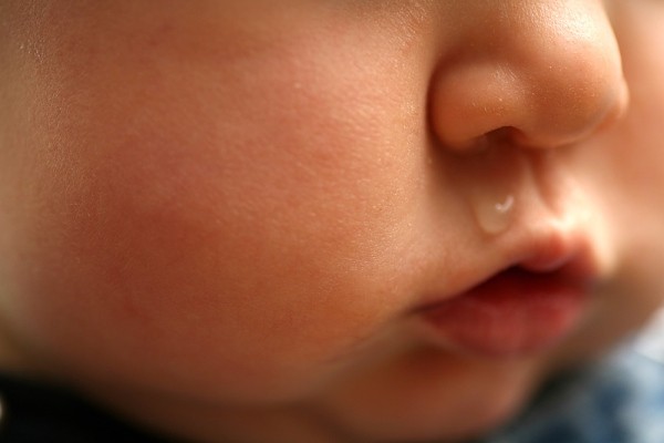 Trẻ bị sổ mũi, chảy nước mũi - Nguyên nhân và cách điều trị hiệu quả